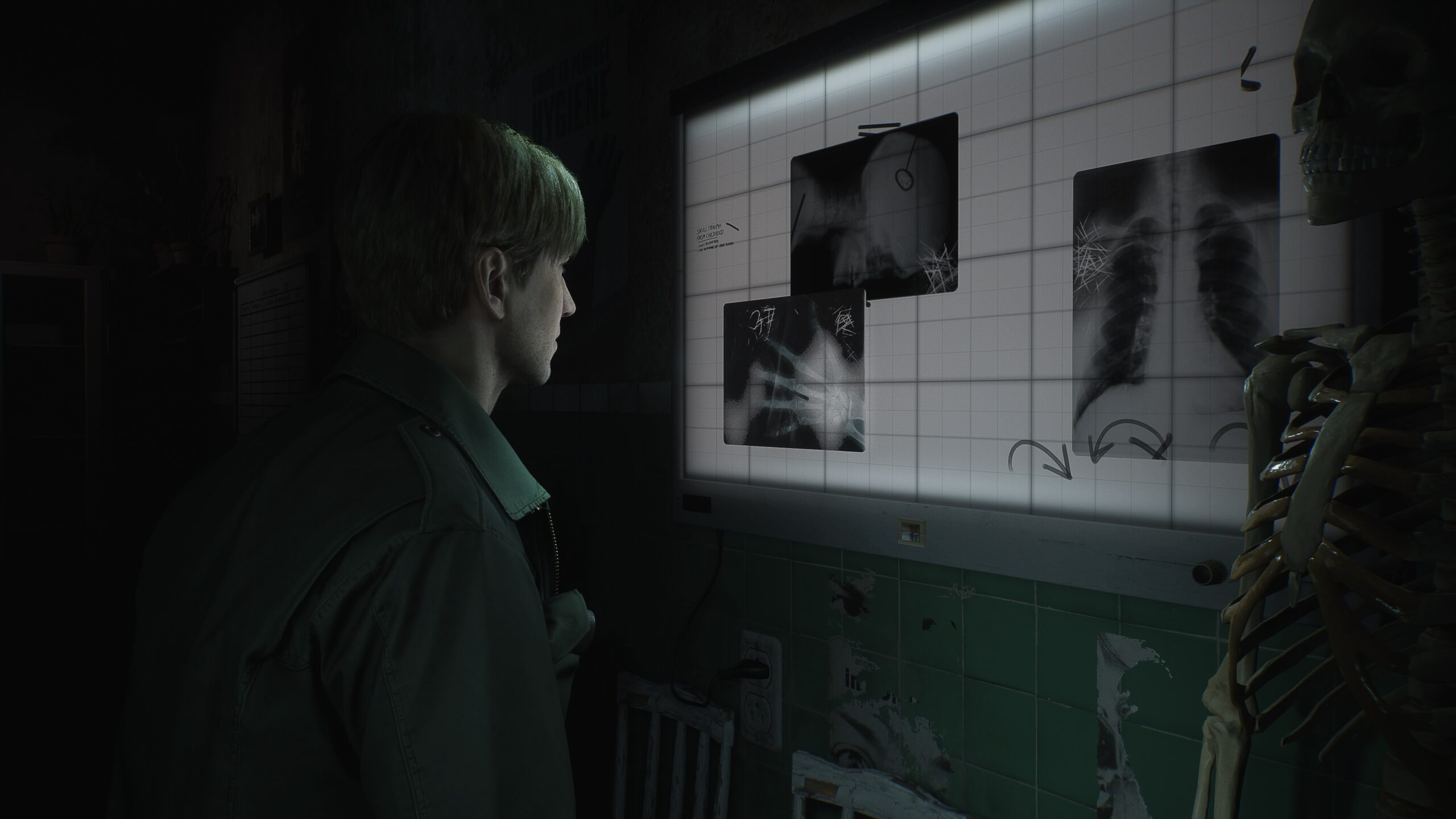 Remake de Silent Hill 2 revelado, primeiros detalhes da